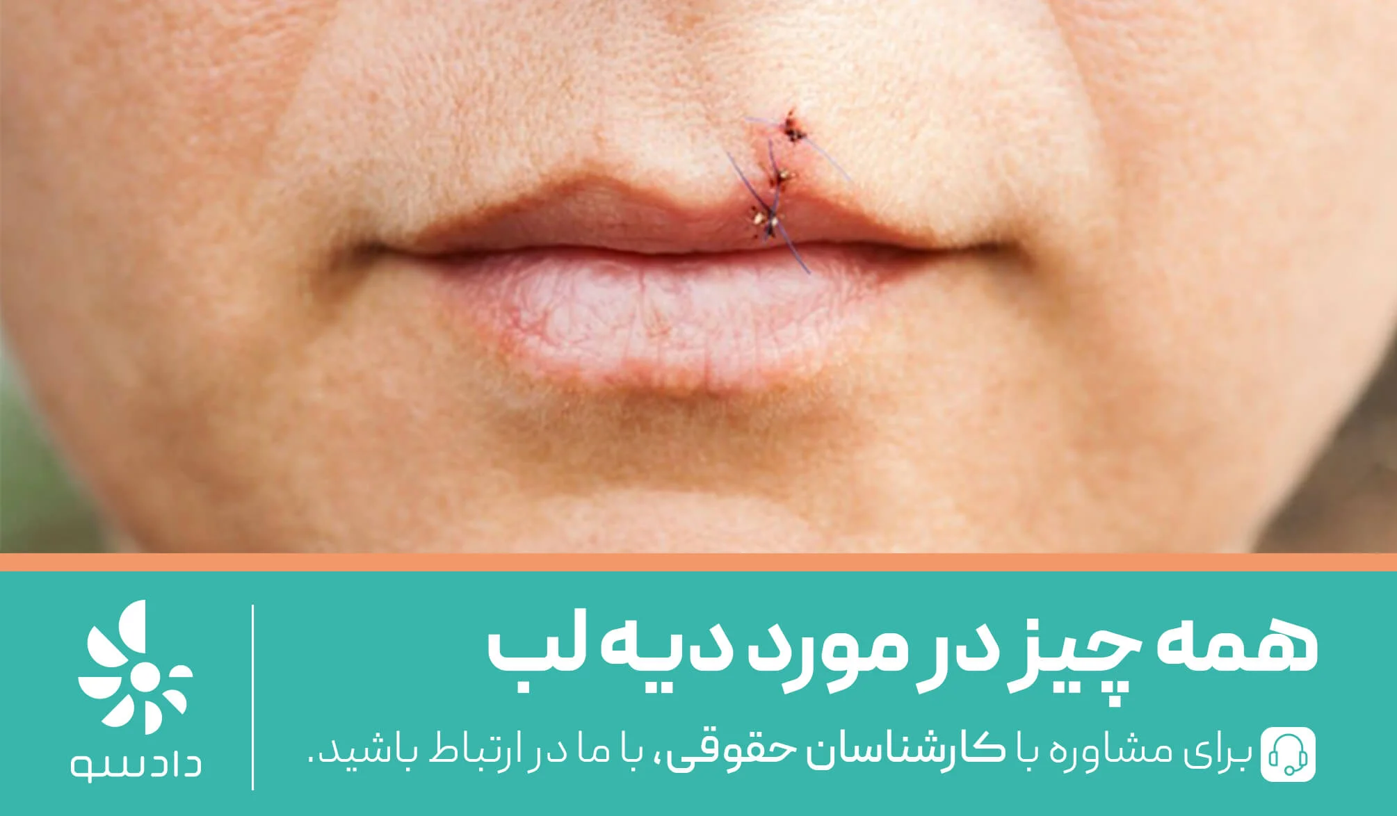 دیه لب در سال ۱۴۰۵؛ دیه کبودی لب و دیه بخیه لب چقدر است؟