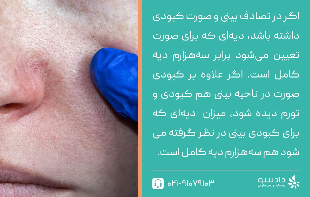 دیه کبودی و ورم بینی