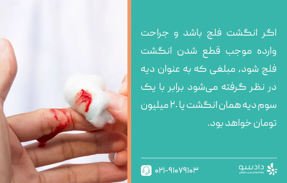 دیه قطع شدن دست از بازو