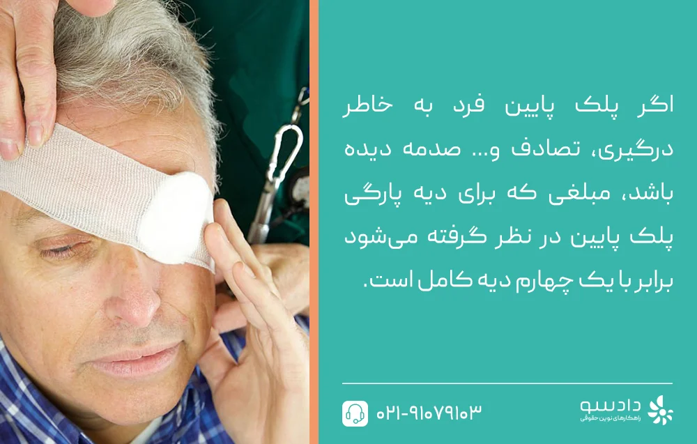 دیه از بین بردن چهار پلک هر دو چشم