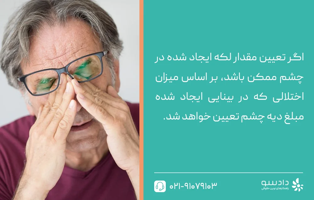 دیه از بین بردن چشم کسی که تنها یک چشم بینا دارد