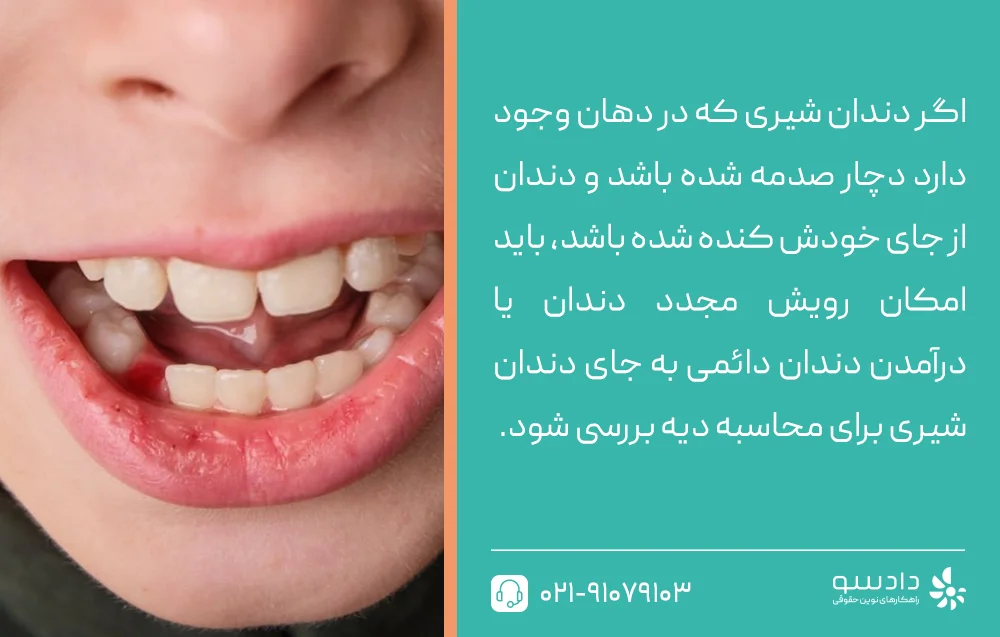 دیه کندن دندان شیری